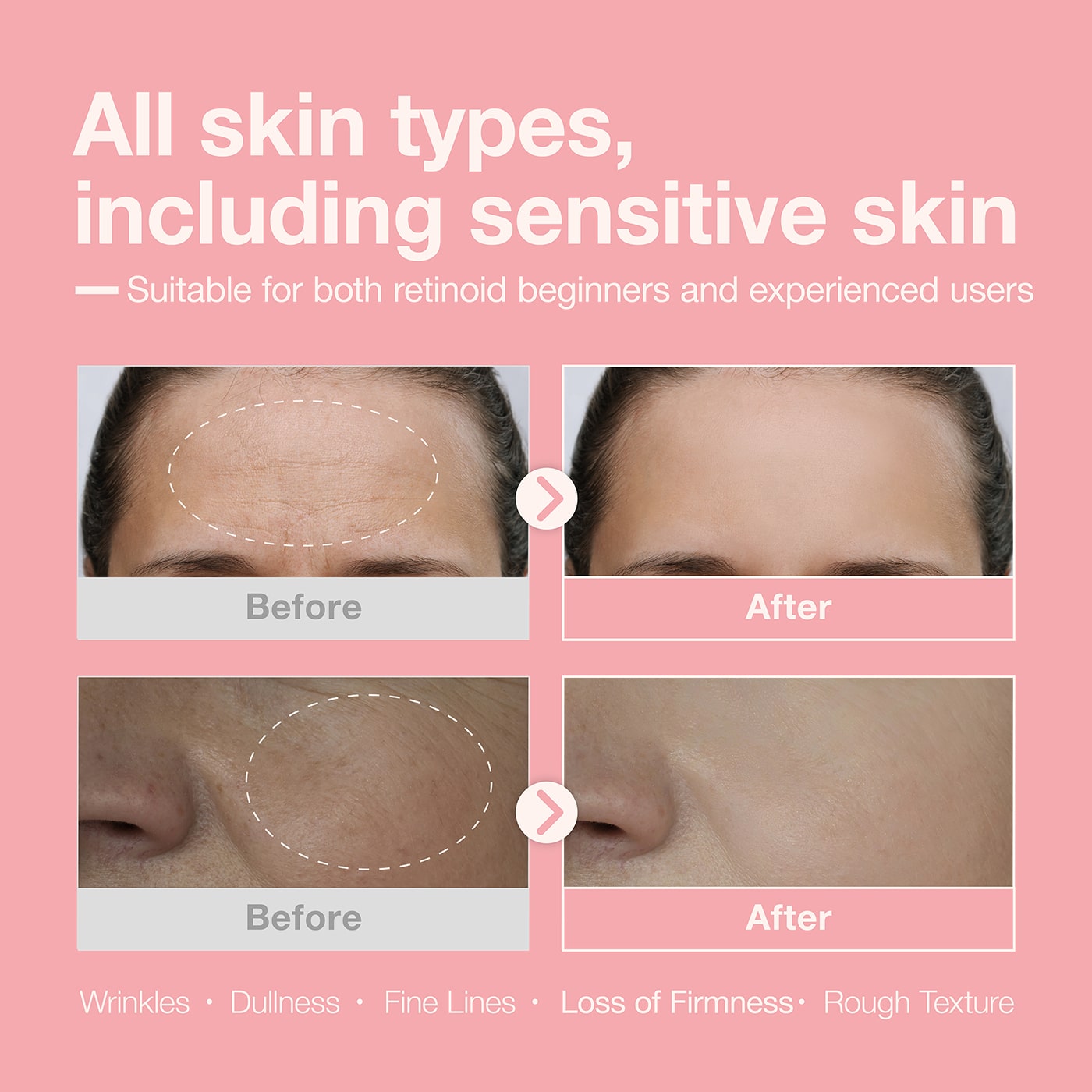 [Retinol + Retinal + Peptide] Booster Serum