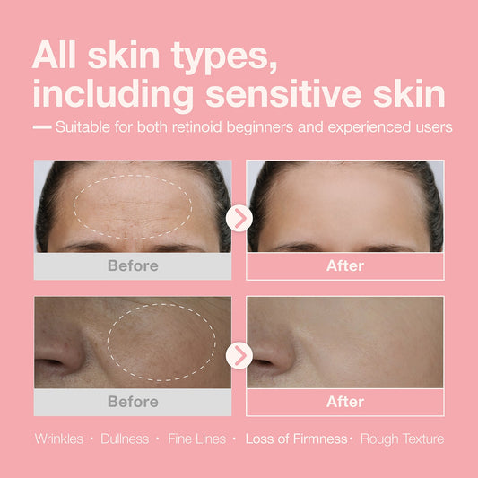 [Retinol + Retinal + Peptide] Booster Serum